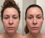 LED Face & Neck Sculpting Device with EMS & Heat Therapy