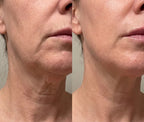 LED Face & Neck Sculpting Device with EMS & Heat Therapy